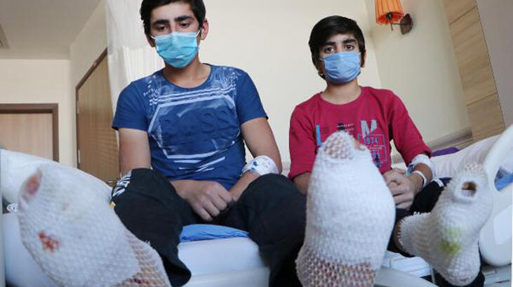  Ayak tabanları patladı