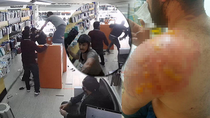  Vücuduna kaynar su döktüler