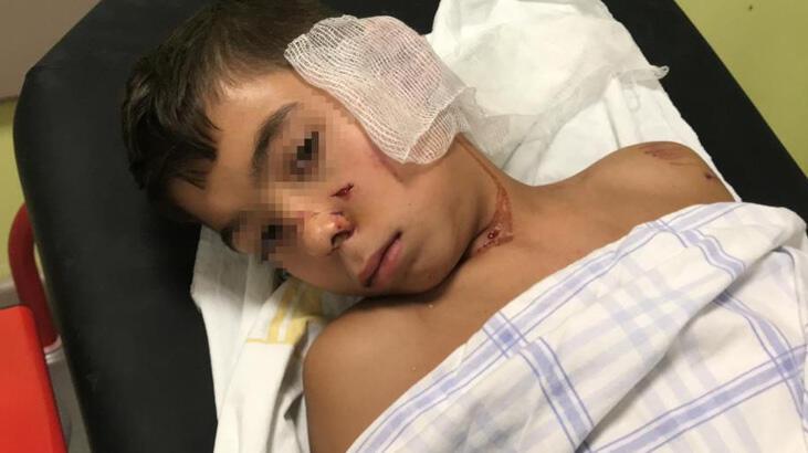 12 yaşındaki çocuk dehşeti yaşadı! 'Kanlar içinde yatıyordu'