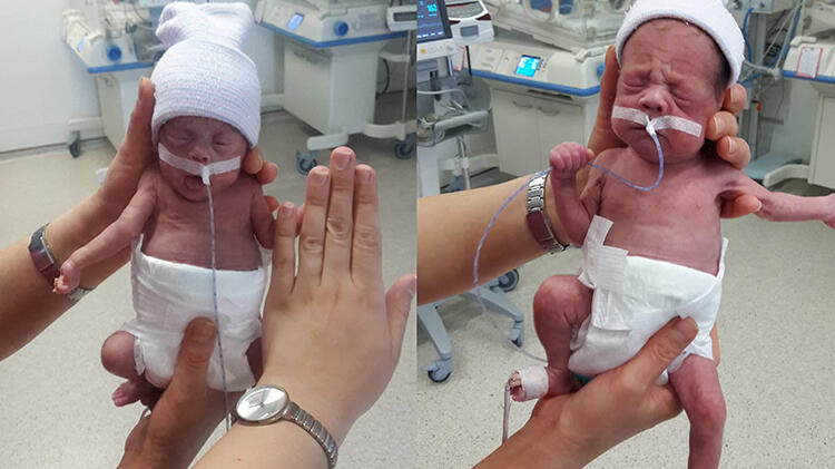 490 gram ve 680 gram doğan ikizlerden haber var!