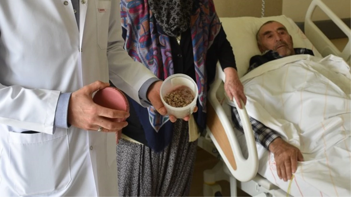 83 yaşındaki hastanın mesanesinden 250'den fazla taş çıkarıldı! Manzara ameliyatı yapan doktoru da şaşırttı