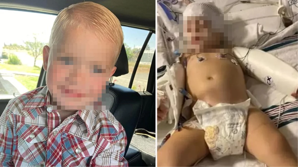 ABD'de 2 yaşındaki çocuk beyin yiyen amip nedeniyle hayatını kaybetti