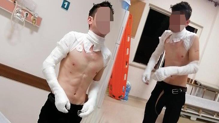 Adresi yanlış verdiği ambulansın geç geldiğini iddia edip, kendini yaktı
