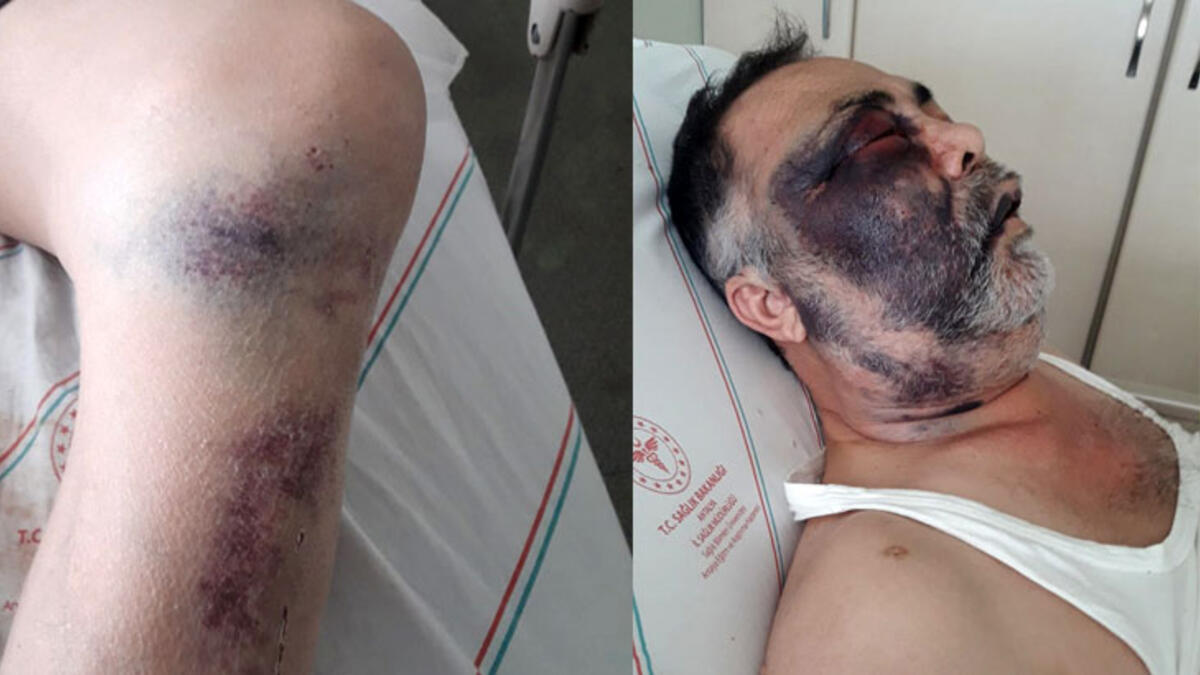 Antalya'daki vahşette yeni gelişme