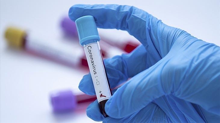Aşı olmayan doktor, koronavirüse yenildi