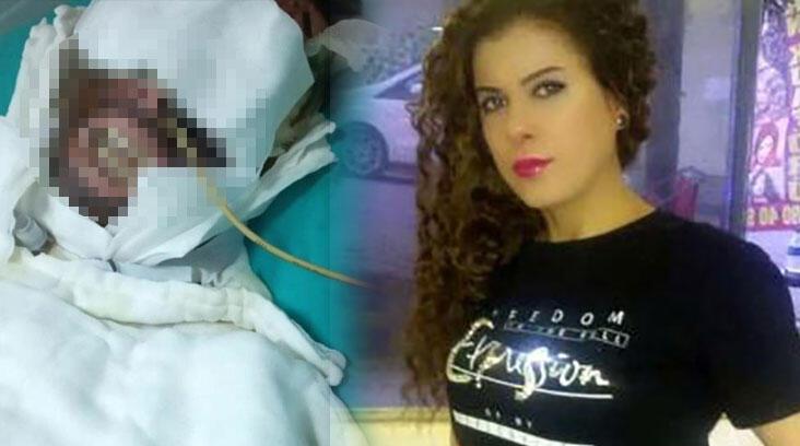 Aşkına karşılık bulamadı, kimyasal madde döktü! Kendisini böyle savundu