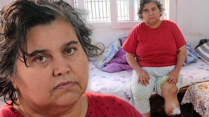 Ayağı kesilen diyabet hastası, protez bacak için yardım bekliyor