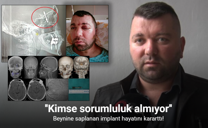 Beynine saplanan implant hayatını kararttı: 2 yıldır adalet bekliyor