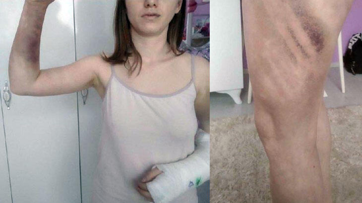 Beyzbol sopasıyla 18 saat boyunca dövdü! İşte istenen ceza