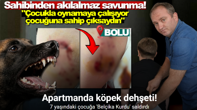 Bolu’da Belçika kurdu çocuğu kalçasından ısırdı, sahibinin sözleri pes dedirtti