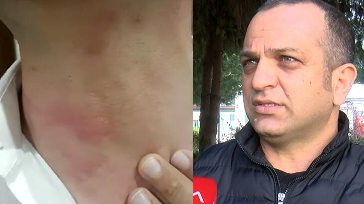 Çam kese tırtılı hastanelik edebilir'