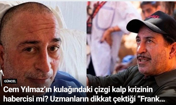 Cem Yılmaz’ın kulağındaki çizgi kalp krizinin habercisi mi? Uzmanların dikkat çektiği “Frank işareti”
