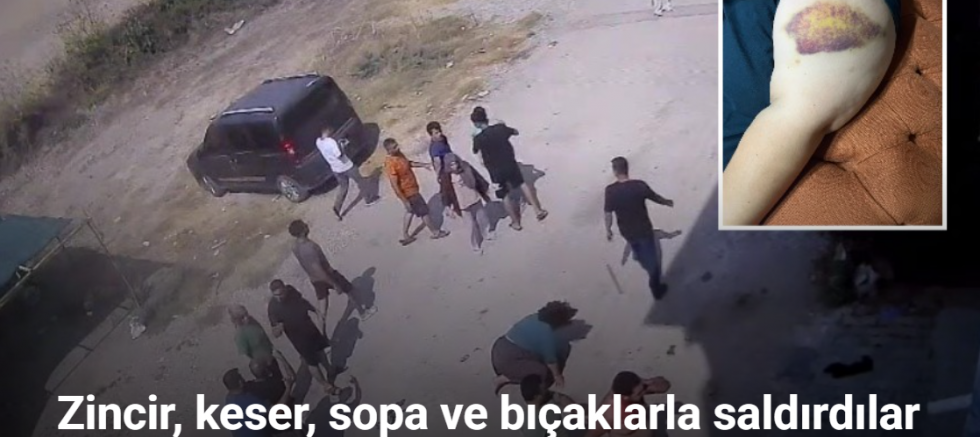 Çocukların gürültüsü kavgaya dönüştü: Zincir, keser, sopa ve bıçaklarla saldırdılar