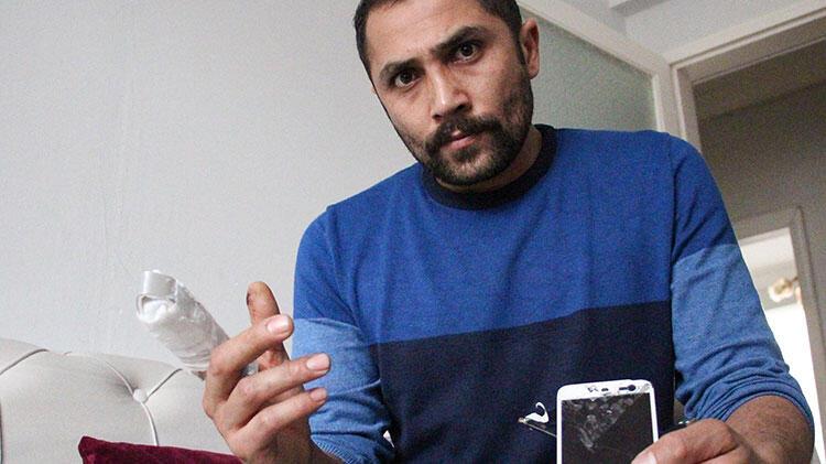 Dehşeti yaşadı! Bomba gibi patlayan powerbank parmağını kopardı!