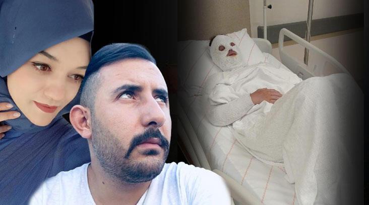 Dehşetin böylesi! 'Su sayacına bakacağız' dedi, kimyasal madde attı
