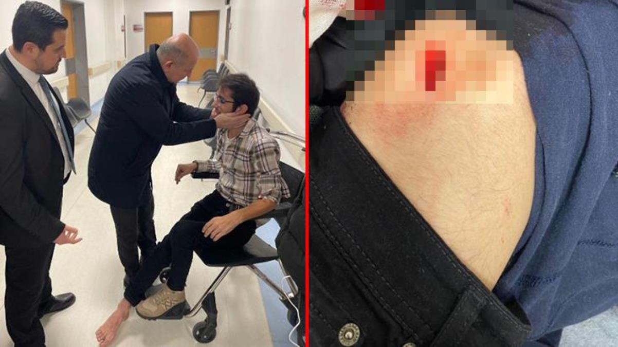 DEVA Partililere esnaf ziyaretinde bıçaklı saldırı: Motosikletle gelip 2 kişiyi yaraladı
