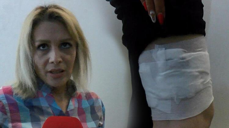 Ekmek almaya giden kadın, köpeklerinin saldırısına uğradı!