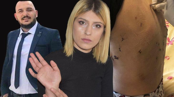 Eşini 38 yerinden bıçaklayan kocanın çocuklarını görmesine mahkeme yasağı