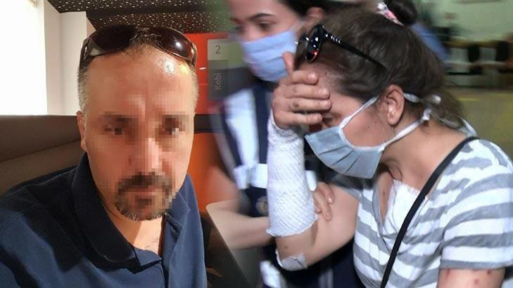 Eski erkek arkadaşının yüzüne kezzap atmıştı! Tahliye oldu