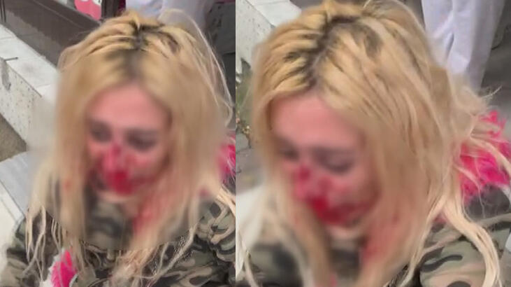 Eski sevgilisinin oğlu kadına kafa atarak kanlar içinde bıraktı!