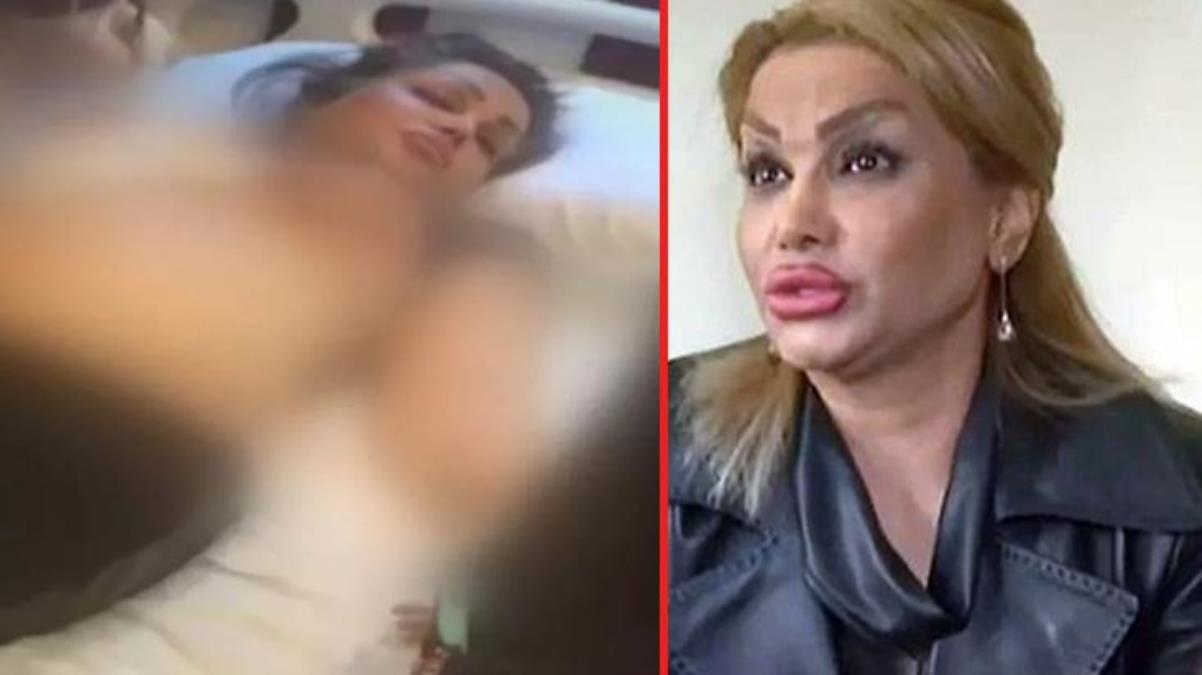 Estetik ameliyatı olan kadının hayatı kabusa döndü! Hem göğüslerinden hem de kocasından oldu
