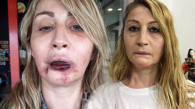 'Estetik mağduru kadınlar, toplumun önyargısından çekinerek, öne çıkamıyor'