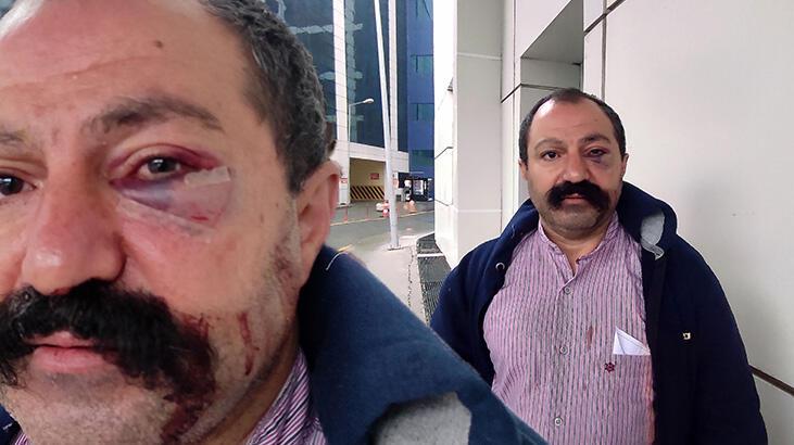 Ev sahibinin kardeşi kiracıya dehşeti yaşattı! 'Küfür ederek saldırdı'