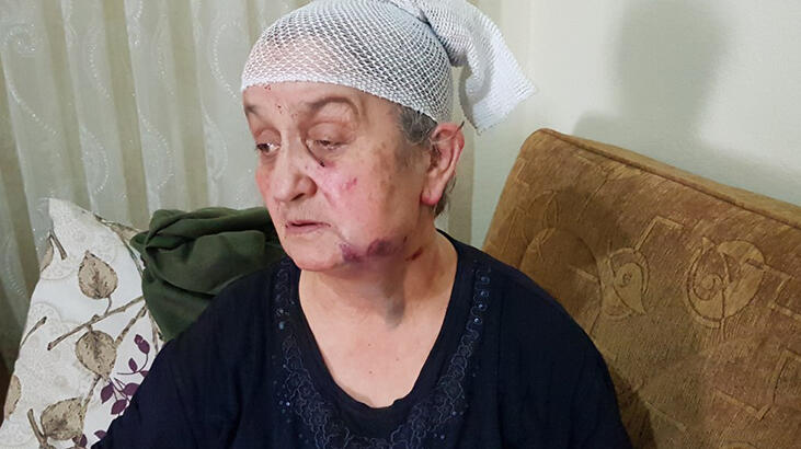 Evine giren gaspçıdan ölü taklidi yaparak, kurtuldu!