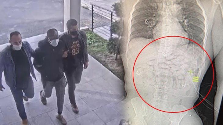 Fenalaşınca her şey anlaşıldı