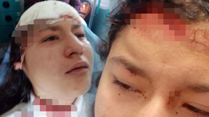 Genç kız selfie çekerken 5 köpeğin saldırısına uğradı