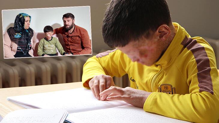 Gözleri kapanan cilt kanseri Salih: Ailemi merak ediyorum
