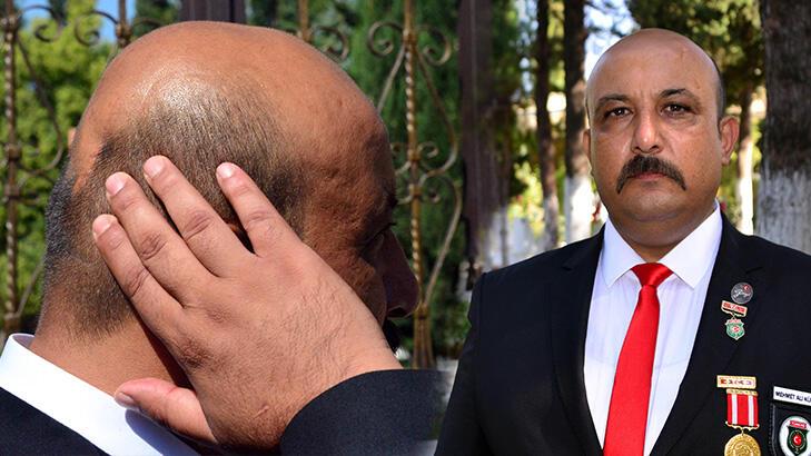 Güneydoğu gazisi, 13 yıldır kafasındaki Kalaşnikof mermisi ile yaşıyor