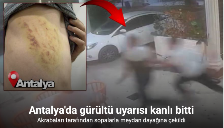 Gürültü tartışması sopalı kavgayla bitti: O anlar kamerada