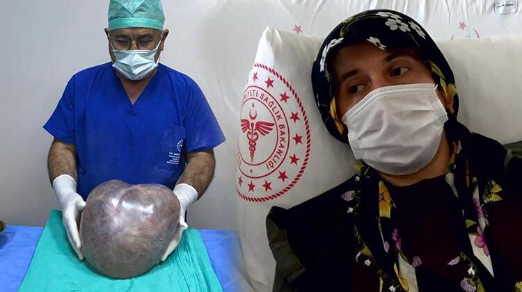 Hamile olduğunu düşünen kadının karnından 6 kilo 400 gram kitle çıktı!