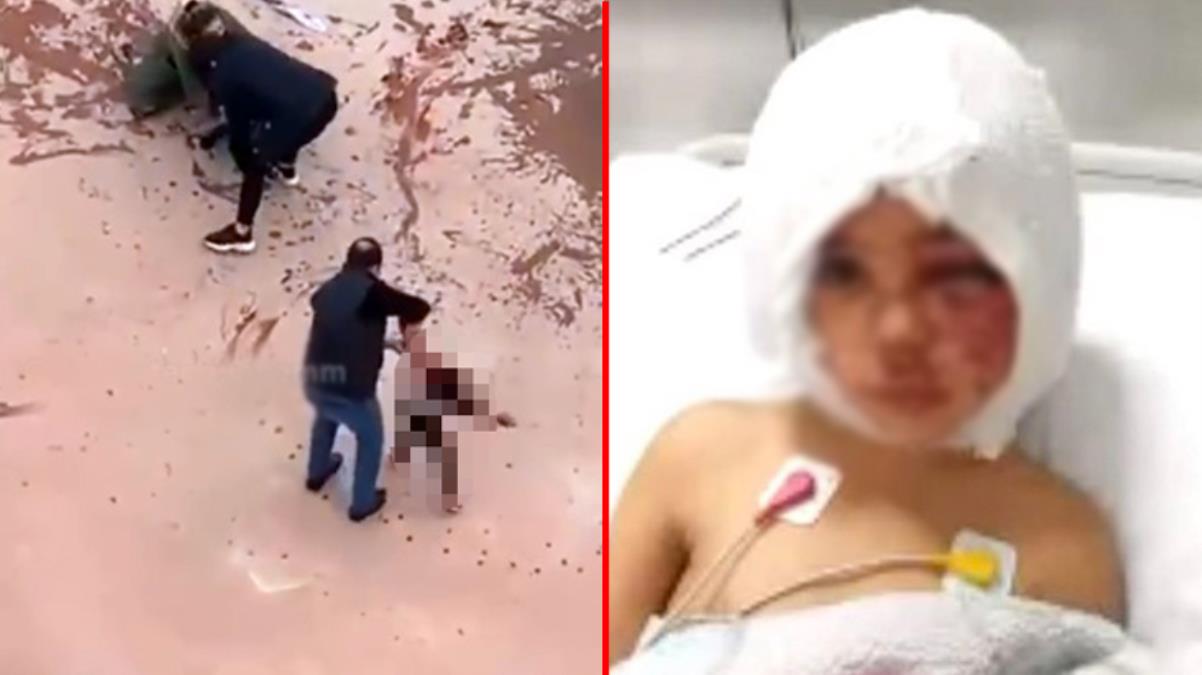 Hayati tehlikesi devam ediyor, duyma kaybı yaşayabilir
