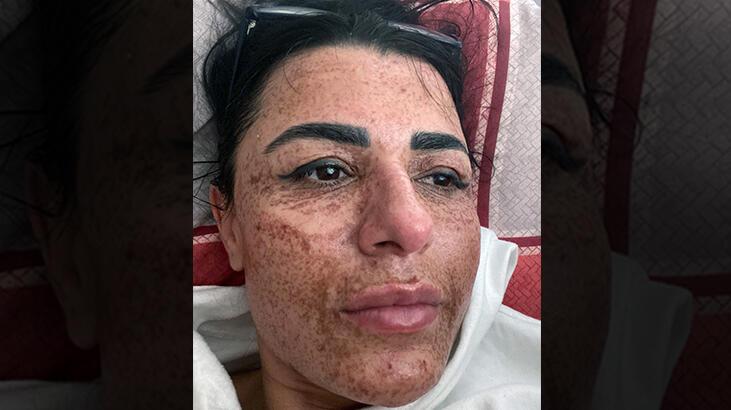 İnanılmaz değişim! 'Artık aynaya bakabiliyorum'