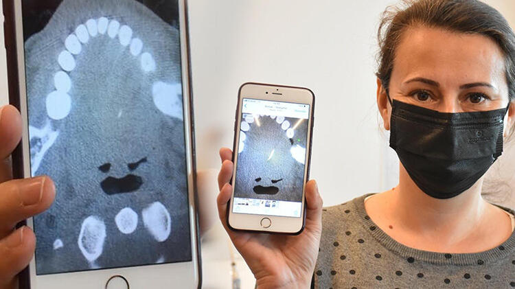 İnanılmaz olay! Kokoreç yerken diline iğne battı