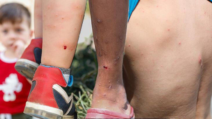 İstanbul'da 'Aedes' türü sivrisinek tehdidi!