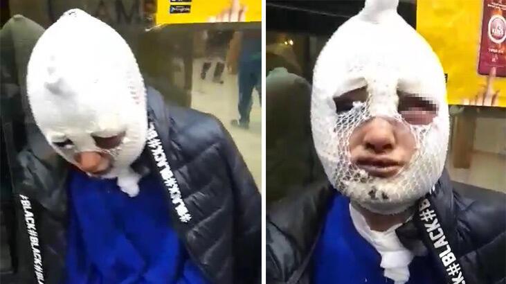 İsyan ettiren olay! Eski sözlüsüne cinsel saldırıda bulunup başından aşağı kızgın yağ döktü