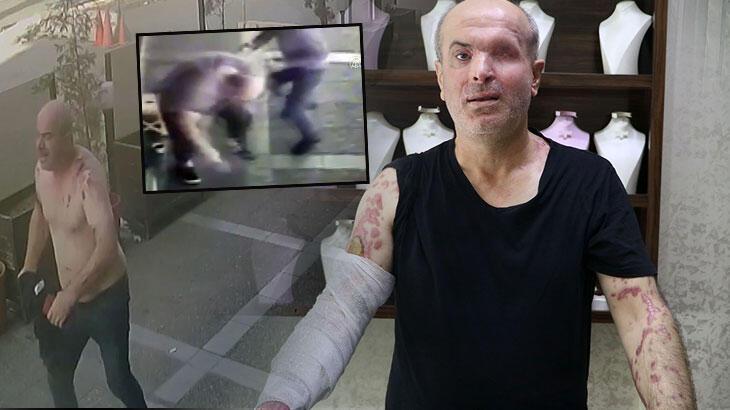 İzmir'de kezzap dehşeti! Yüzüne kezzap attı