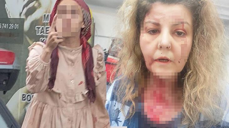 Kadınlar birbirine girdi kendisini uyarınca bana saldırdı'