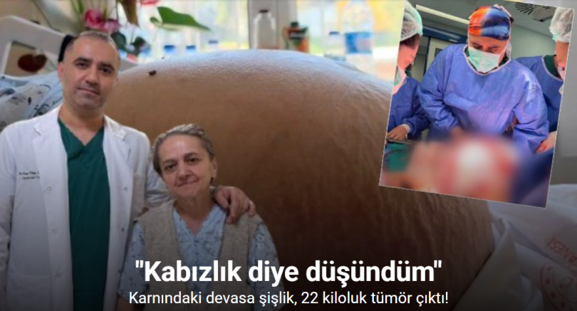 Karnındaki devasa şişlik 22 kiloluk tümör çıktı: 