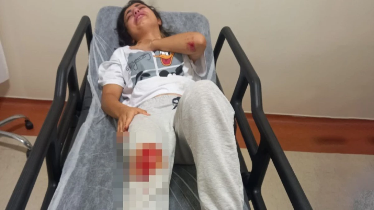 Kastamonu'da başıboş sokak köpeklerinin saldırdığı kadın hastanelik oldu