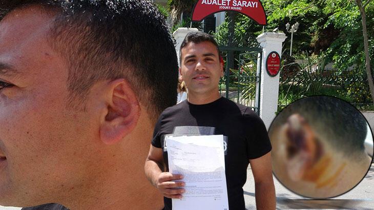Kavgada kopan kulağını martı kaptı