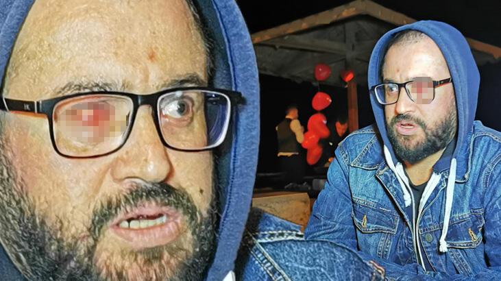 Kız arkadaşıyla tartışırken kabusu yaşadı! 4 kişinin saldırısında gözünü kaybetti