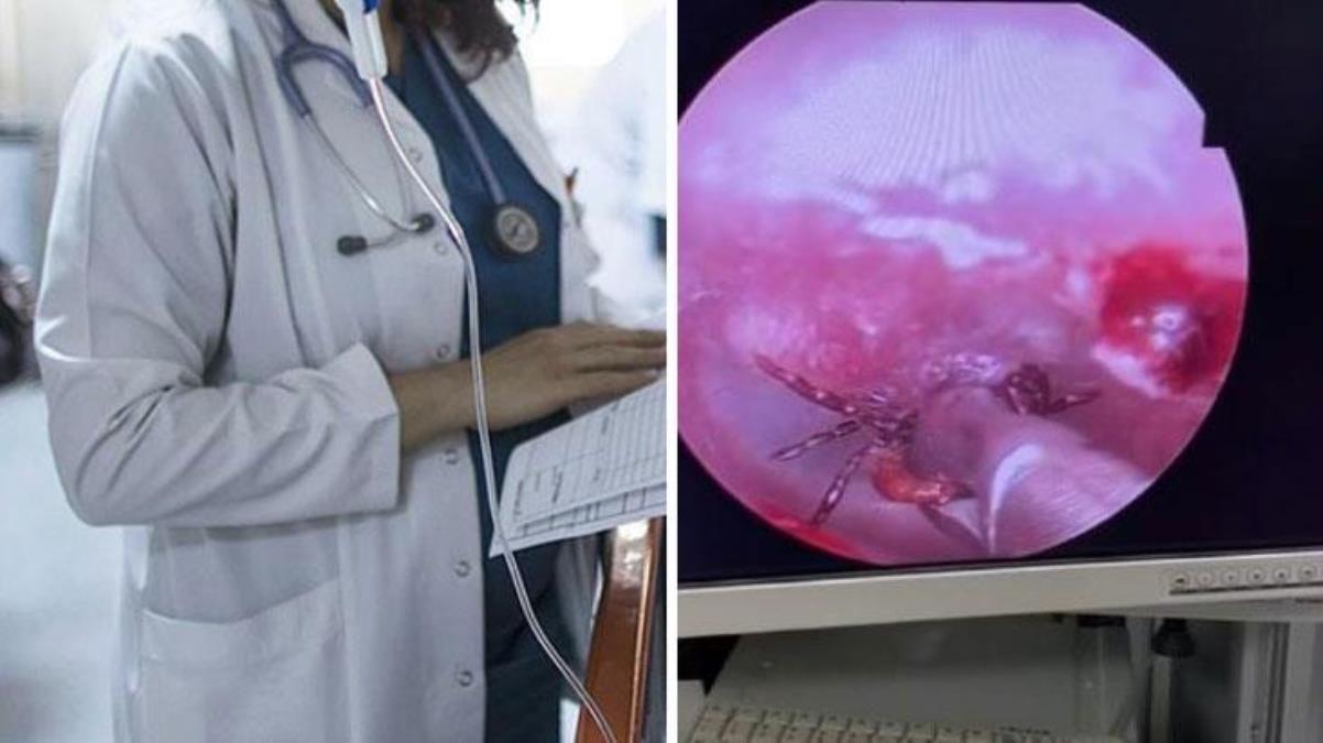 Kulak ağrısıyla hastaneye gitti, kulağından kene çıktı