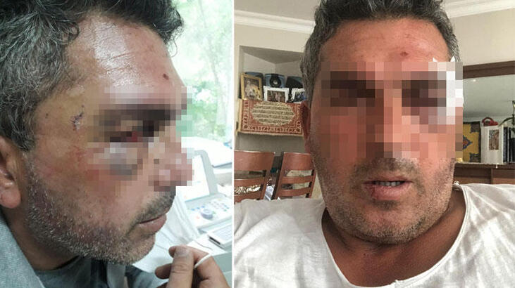 Kurye dehşeti! Motosikletle başını ezmeye çalıştı...