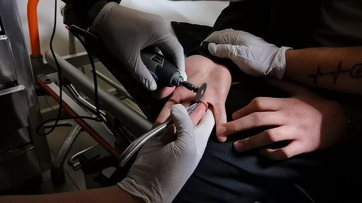 Lise öğrencisinin metal paradan yaptığı yüzük parmağında sıkıştı