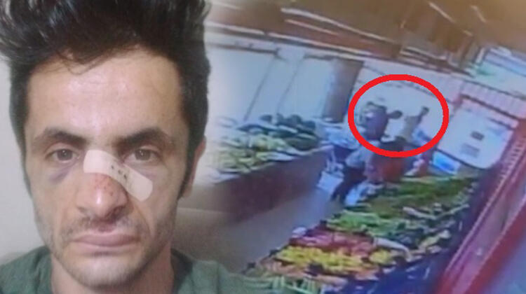 Maske uyarısı yapan market çalışanının burnunu kırdı