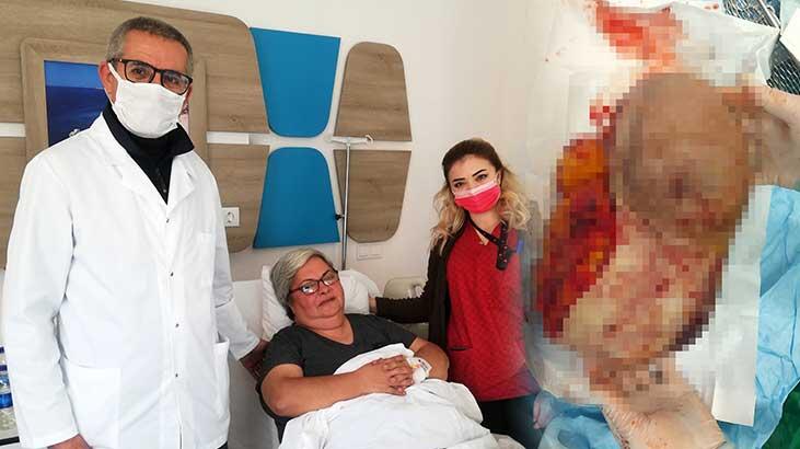 Memesinde fark etti, hemen doktora koştu! 4.5 kiloluk kitle...